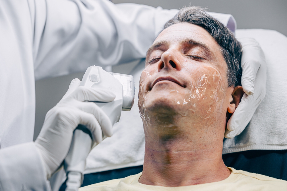 Imagem ilustrativa de homem fazendo ultrassom microfocado no rosto